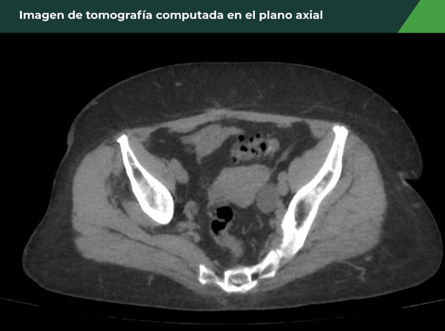 Imagen 2