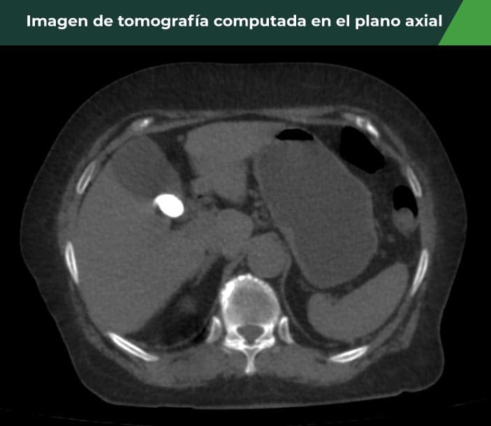 Imagen 2